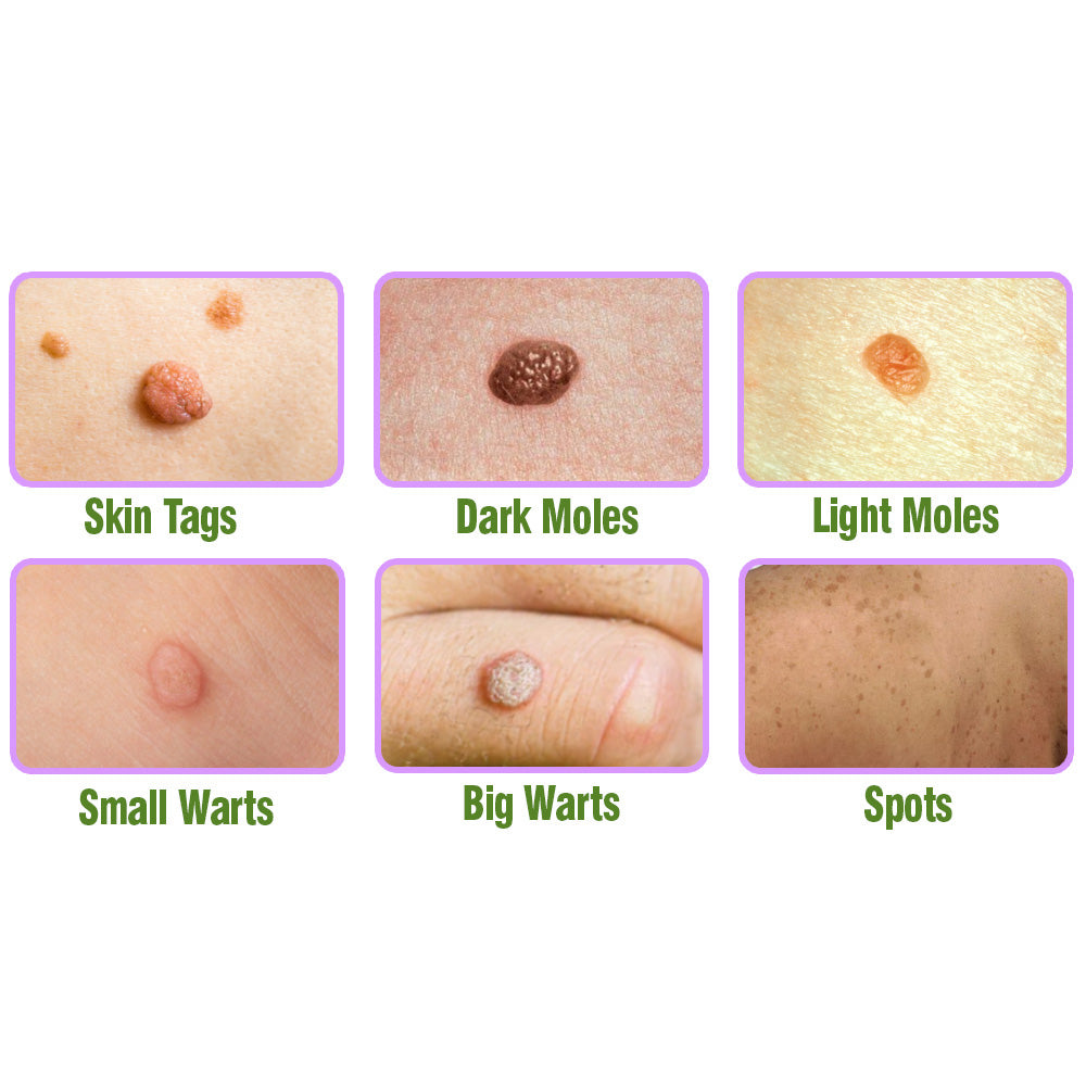 flysmus™ TagOff Beinwell-Kräuterpflege-Serum