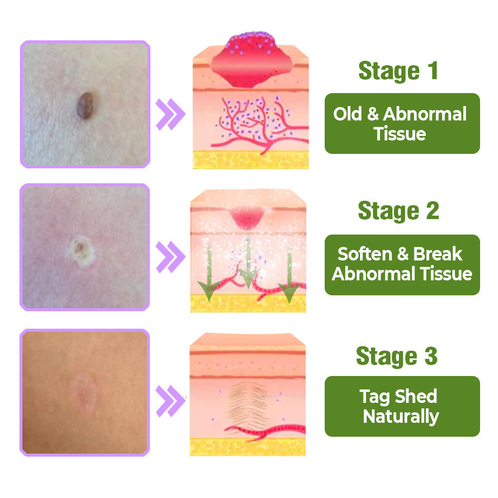 flysmus™ TagOff Beinwell-Kräuterpflege-Serum