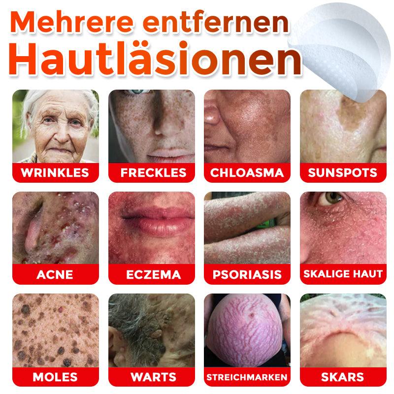 GFOUK® Mikronadel-Botanisches Hautanhängsel-Entfernungspflaster 🇩🇪 Hergestellt in Deutschland
