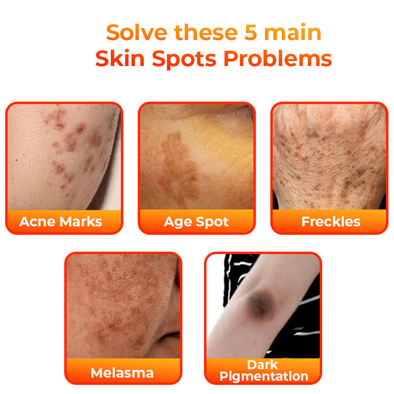 Flysmus™ KojiWhite Kojic Acid Dark Spot Corrector Seife