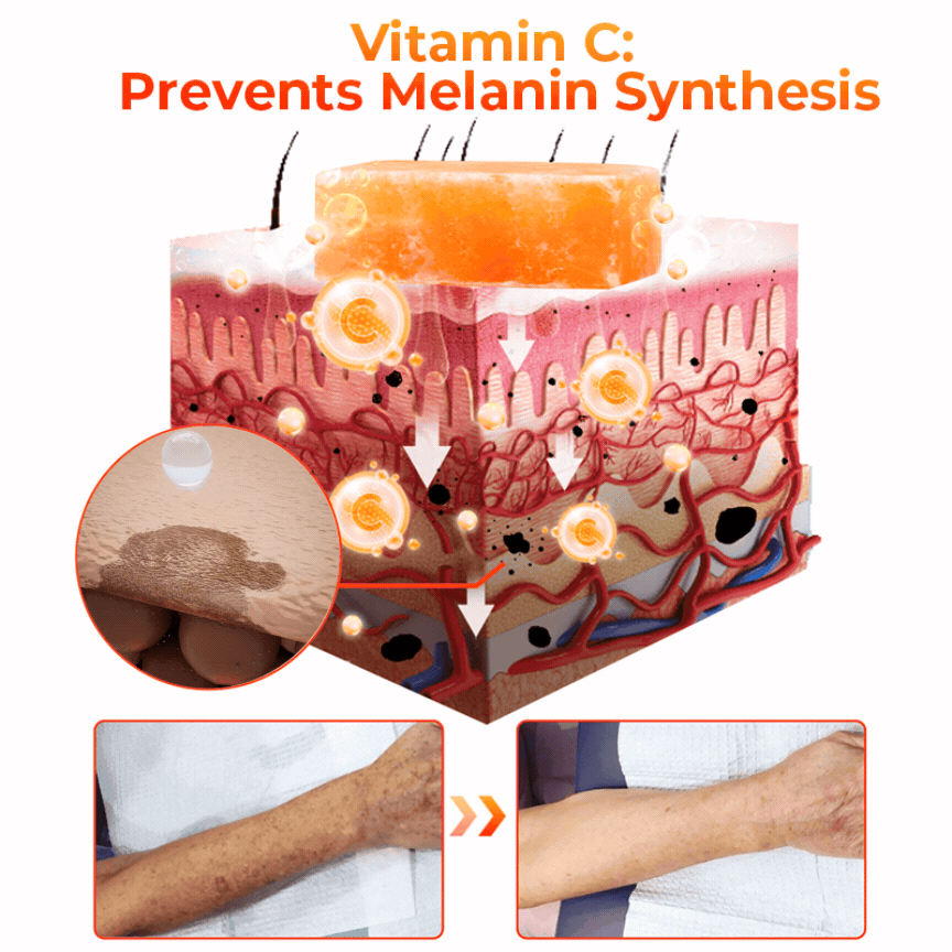 Flysmus™ KojiWhite Kojic Acid Dark Spot Corrector Seife