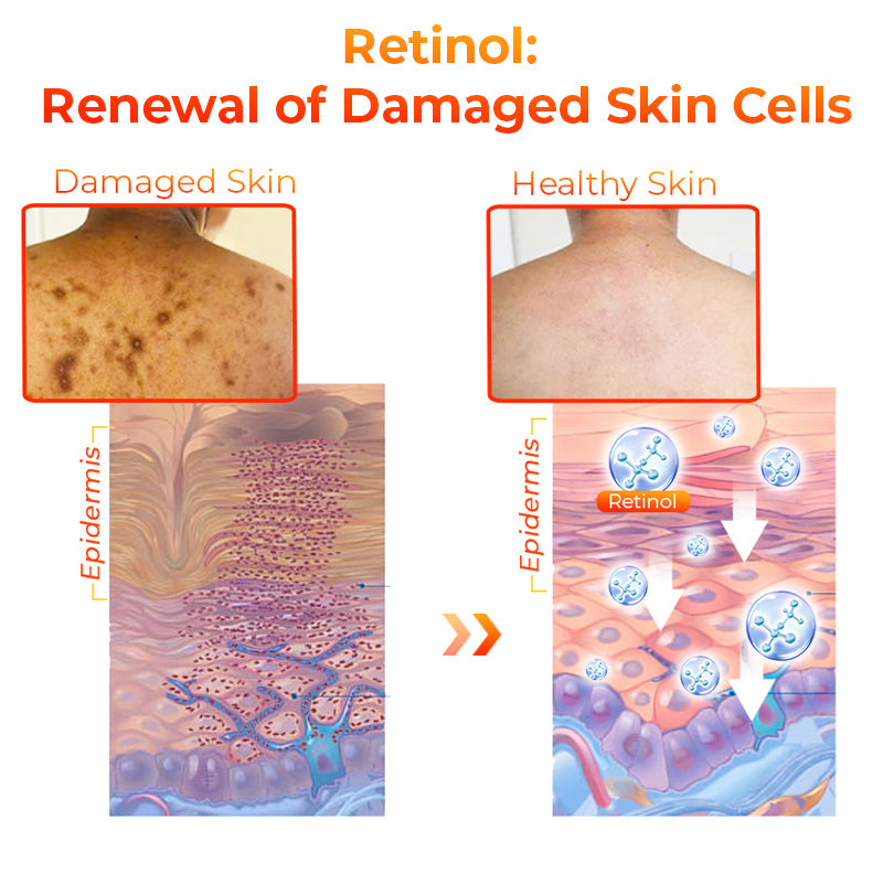Flysmus™ KojiWhite Kojic Acid Dark Spot Corrector Seife