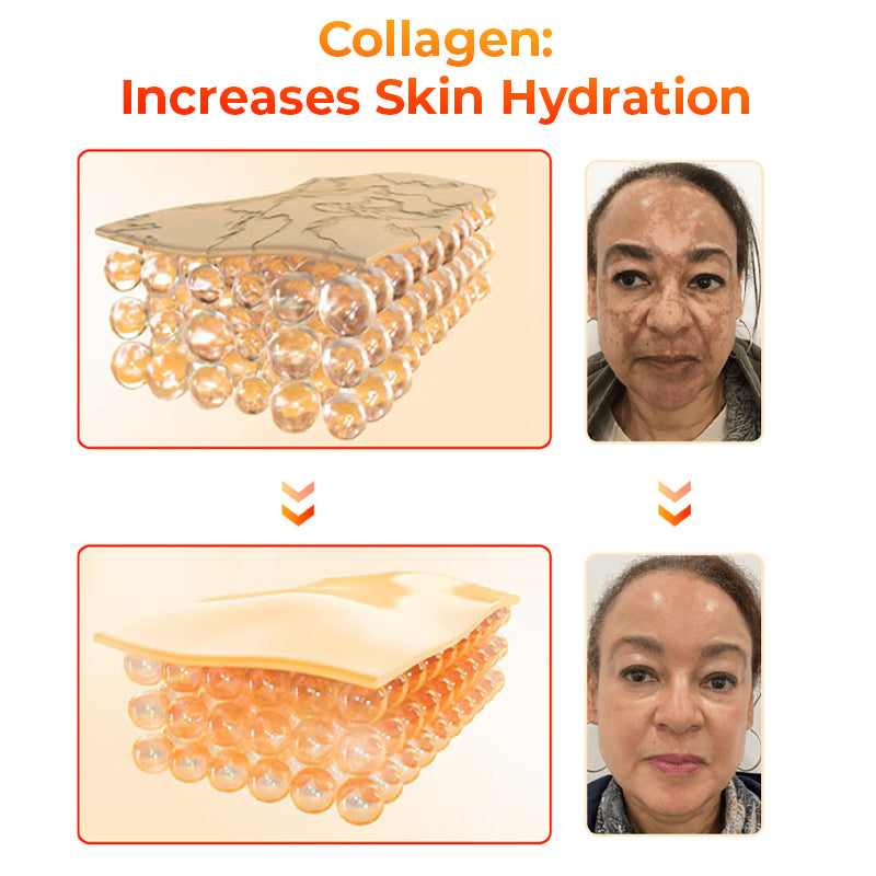 Flysmus™ KojiWhite Kojic Acid Dark Spot Corrector Seife