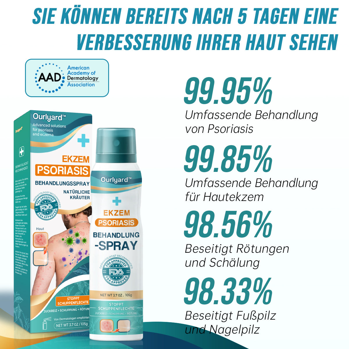 Ourlyard™ Psoriasis- und Ekzem-Naturheilmittel-Spray(🍀Geeignet für alle Hauttypen)