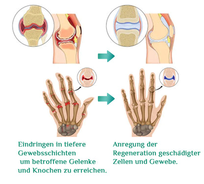 Futusly™ Turmalin Arthro- und Knochentherapie-Armband