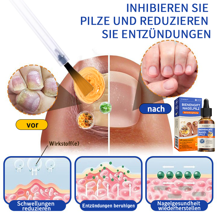 🐝👣Furzero™ Bienengift Nagelpilz Behandlungslösung:Das Nagelpilzproblem vollständig lösen🌟