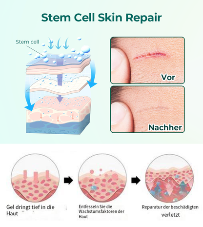 Furzero™ Fortschrittliches medizinisches Stammzellen-Narbengel⭐️