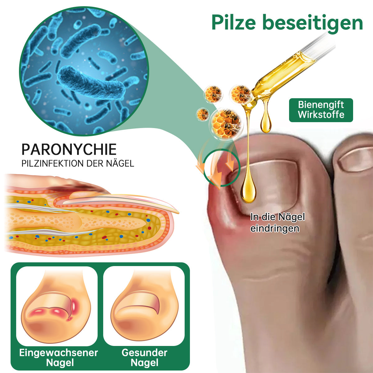 🐝🐝Furzero™ Bienengift Nagelpilz Behandlungslösung:Vollständige Wiederherstellung der Nagelgesundheit👩🏻‍⚕️🌟