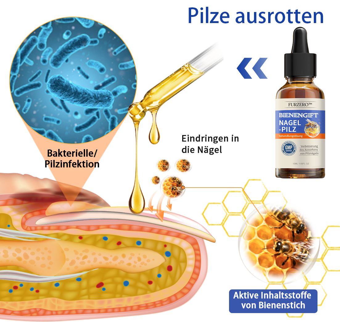 🐝Furzero™ Bienengift Nagelpilz Behandlungslösung:Schnell wirksam und verhindert Rückfälle🌟