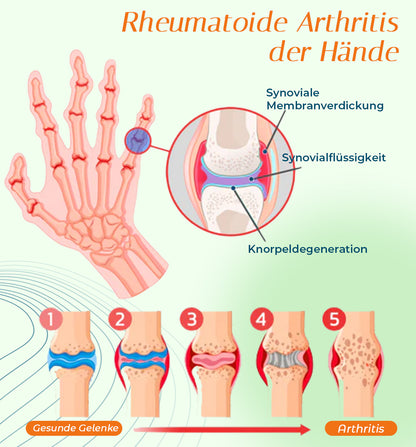 Ourlyard™ Gelenk- und Knochentherapie-Pflaster (natürliche Formel)