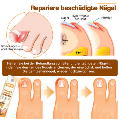 🔥Ourlyard™ Bienengift Nagelpilz Behandlungsspray Pro