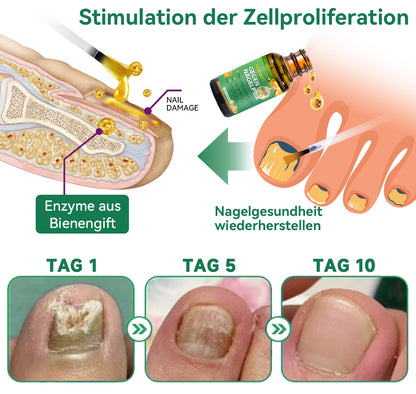 🐝🐝Furzero™ Bienengift Nagelpilz Behandlungslösung:Vollständige Wiederherstellung der Nagelgesundheit👩🏻‍⚕️🌟