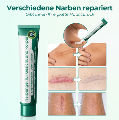 Furzero™ Advanced Medical Grade Stem Cell Scar Gel (🔥🔥 Letzte 30 Minuten zeitlich begrenzter Rabatt)