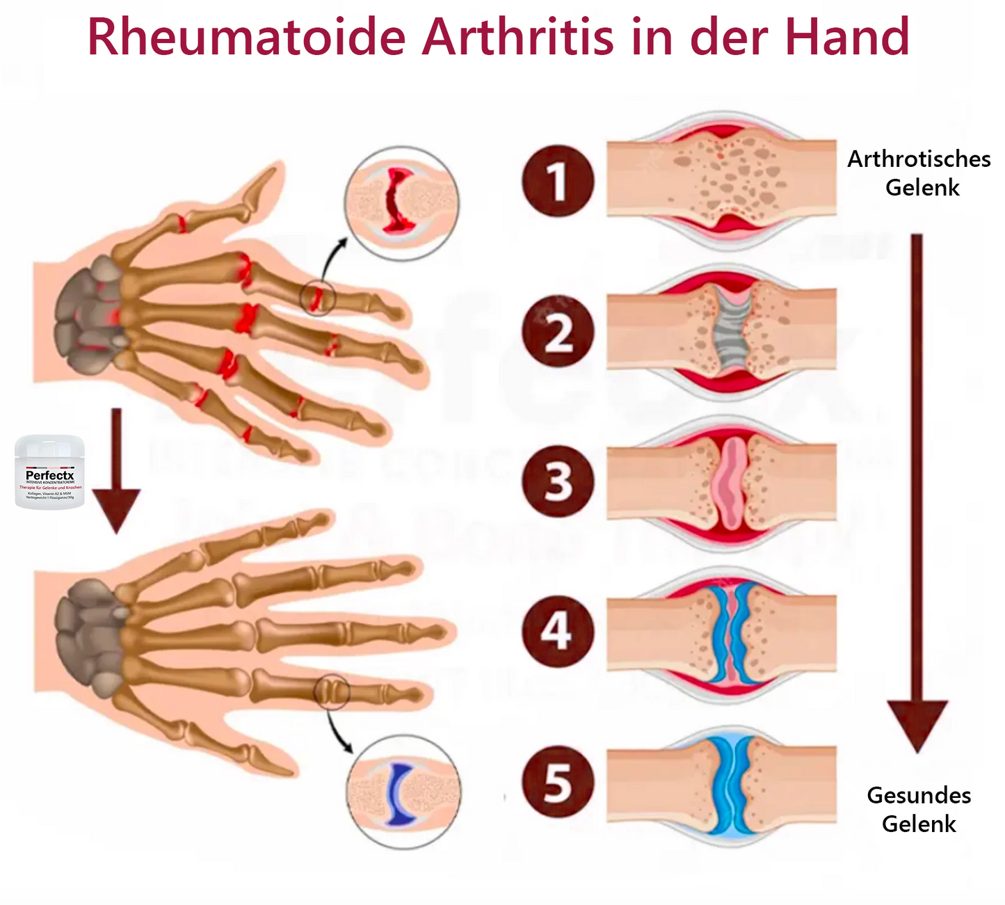 Ourlyard™ Gelenk- und Knochen-Therapie-Creme(Ganzkörper-Wiederherstellung)