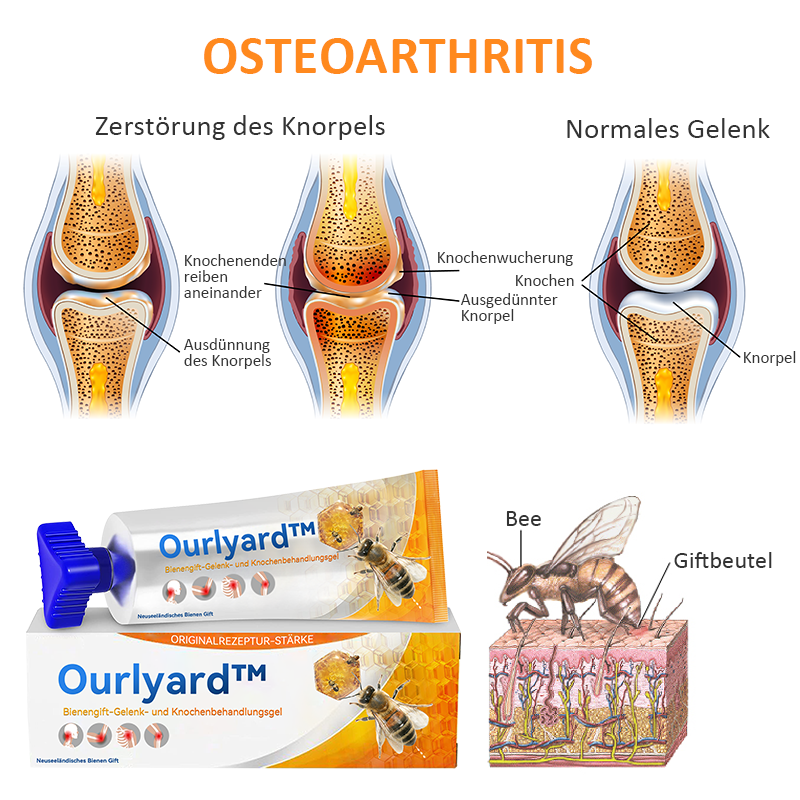 Ourlyard™ Bienengift-Gelenk- und Knochenbehandlungsgel (Ganzkörperregeneration)