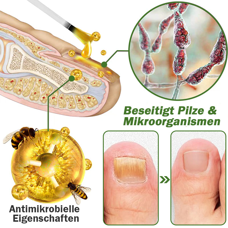 🐝Furzero™ Nagelverteidigung Bienengift-Behandlungsserum pro (Begrenzte Zeit 70% Rabatt)