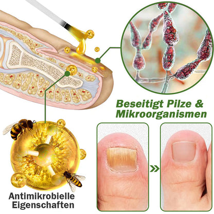 Furzero™ Nagelverteidigung Bienengift-Behandlungsserum pro