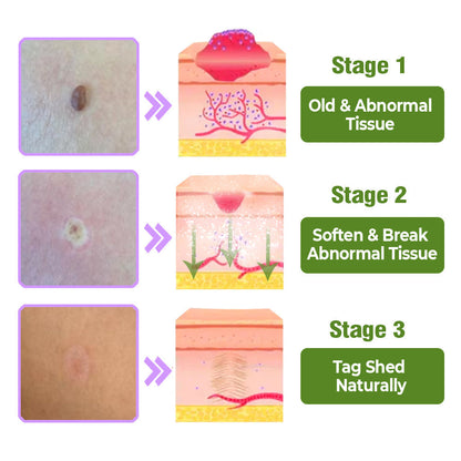 flysmus™ TagOff Beinwell-Kräuterpflege-Serum