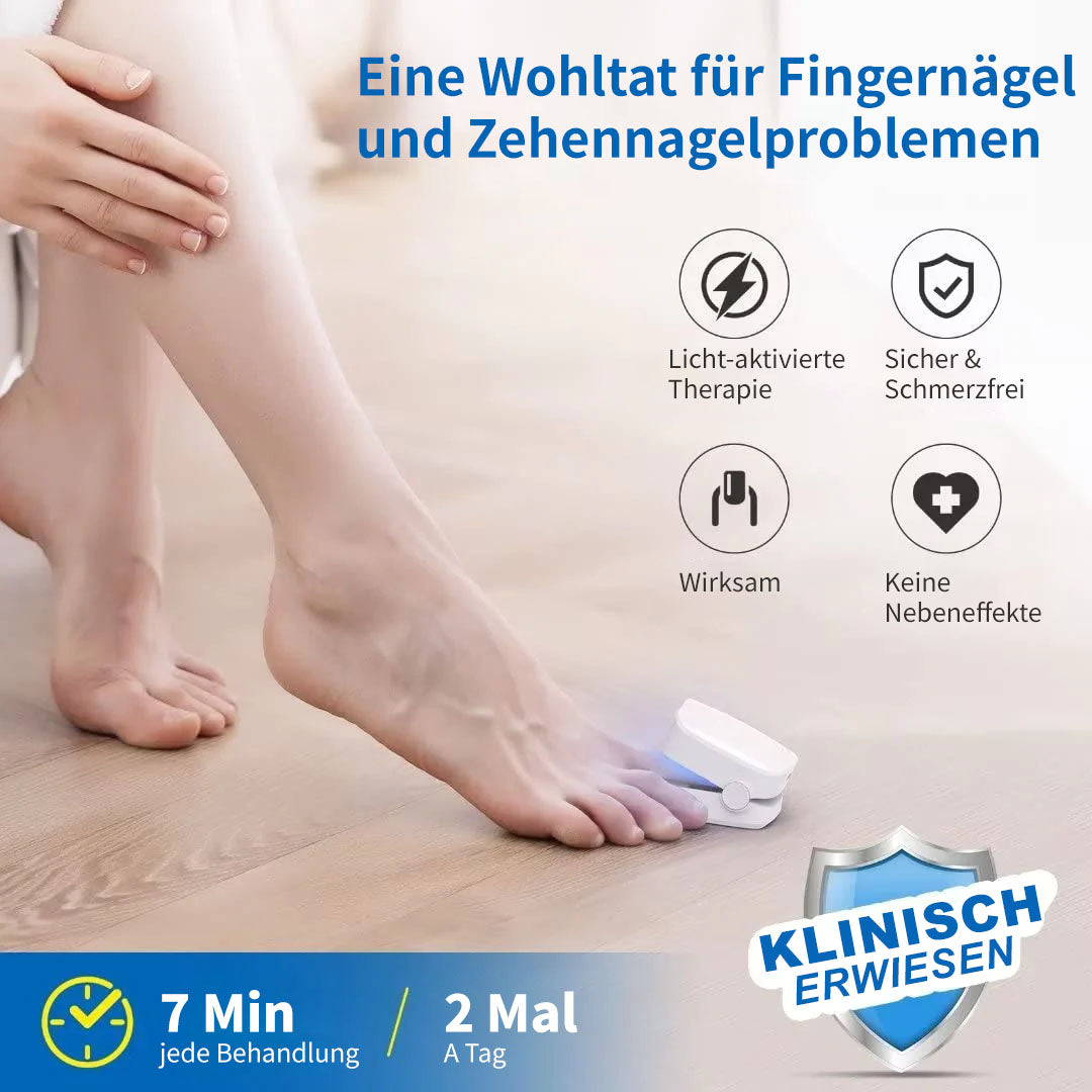 🔥Ourlyard™ Effizientes Lichttherapiegerät zur Behandlung von Nagelerkrankungen