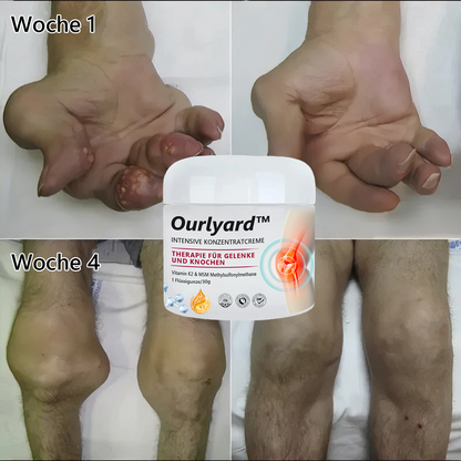 Ourlyard™ Gelenk- und Knochen-Therapie-Creme(Ganzkörper-Wiederherstellung)