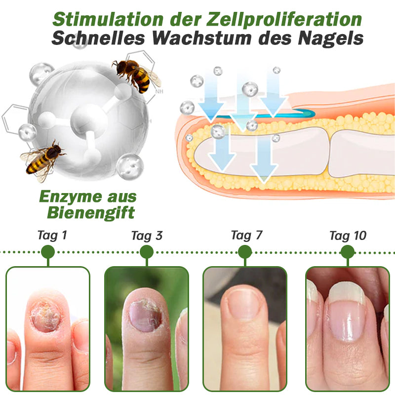 🐝Furzero™ Nagelverteidigung Bienengift-Behandlungsserum pro (Begrenzte Zeit 70% Rabatt)