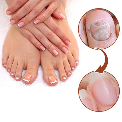 GFOUK™ 7-Tage Nagelwachstum und Stärkung der Nägel 🇩🇪