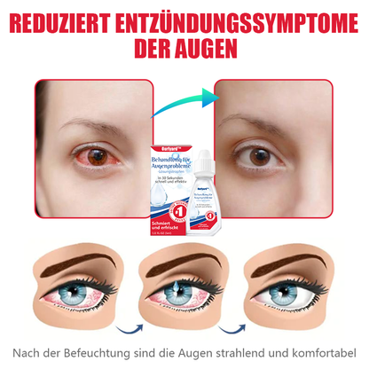 🔥Ourlyard™ Behandlung für Augenprobleme - Lösungstropfen