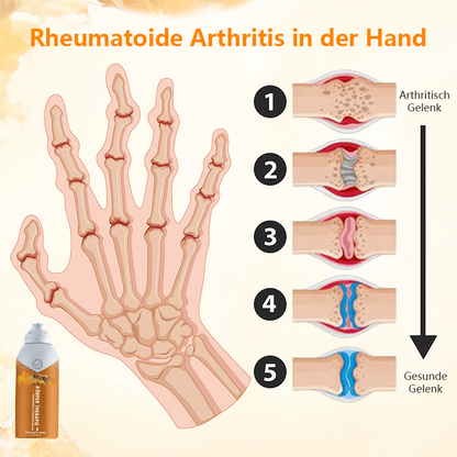 Körper Therapie™ Bienengift Gelenk und Knochentherapie Spray (Ganzkörper Wiederherstellung)