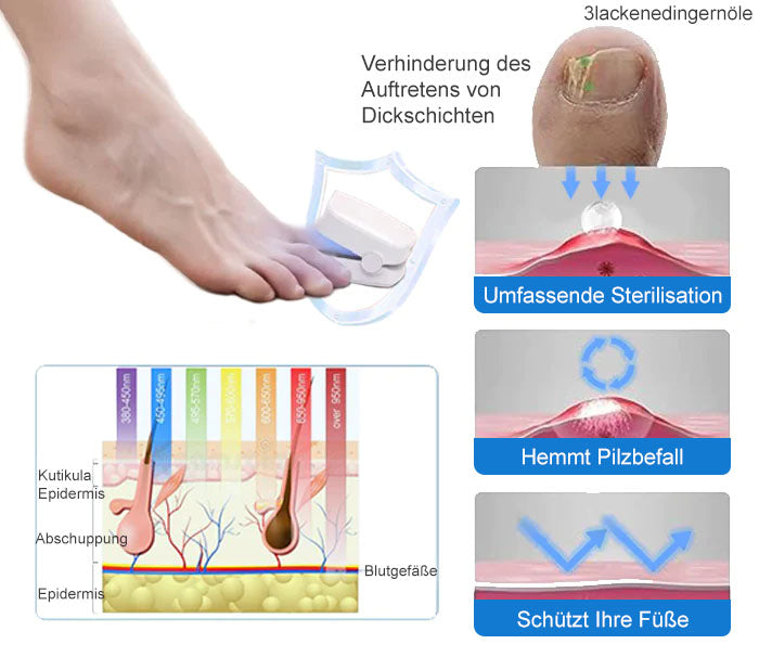 🔥Ourlyard™ Effizientes Lichttherapiegerät zur Behandlung von Nagelerkrankungen