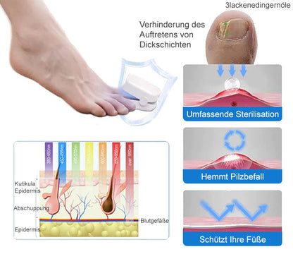 🔥Ourlyard™ Effizientes Lichttherapiegerät zur Behandlung von Nagelerkrankungen