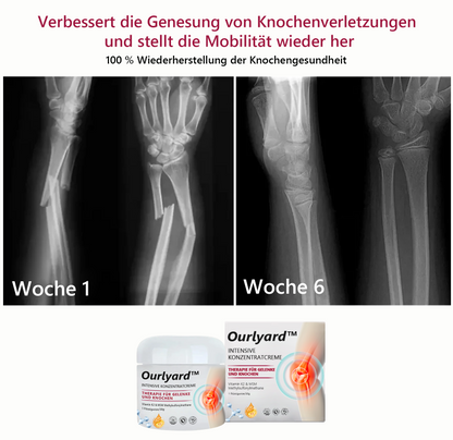 Ourlyard™ Gelenk- und Knochen-Therapie-Creme(Ganzkörper-Wiederherstellung)