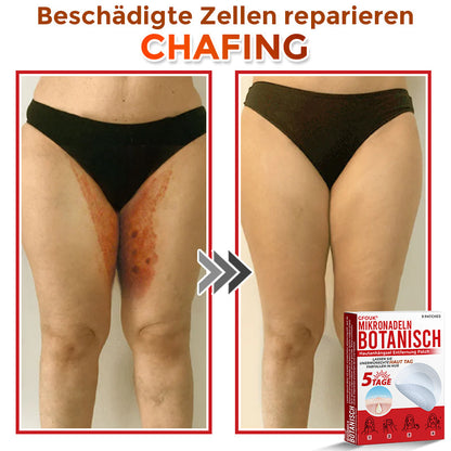 GFOUK® Mikronadel-Botanisches Hautanhängsel-Entfernungspflaster 🇩🇪 Hergestellt in Deutschland