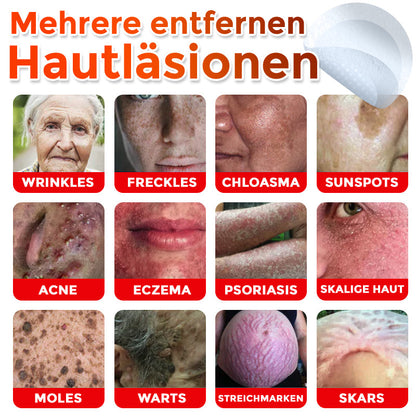 GFOUK® Mikronadeln Botanisch Hautanhängsel Entfernung Patch