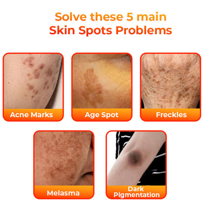 Flysmus™ KojiWhite Kojic Acid Dark Spot Corrector Seife
