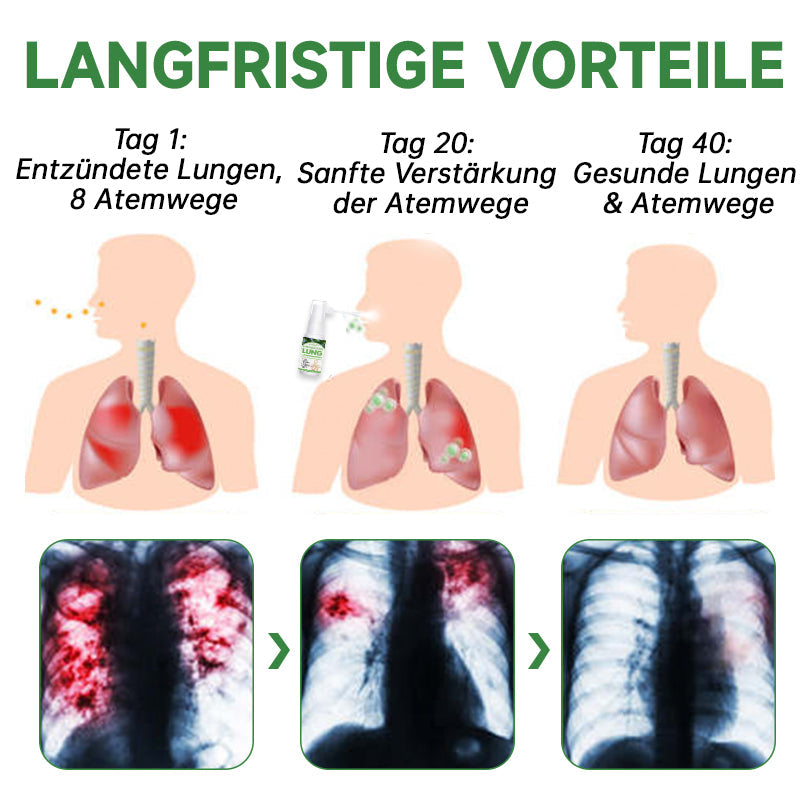 Ourlyard™ Lungenreinigungs- und Reparaturspray