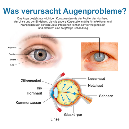 Ourlyard™ Behandlung Augenprobleme Lösung Tropfen